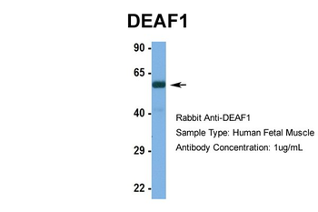 DEAF1 Rabbit Polyclonal Antibody