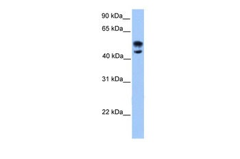 DEAF1 Rabbit Polyclonal Antibody