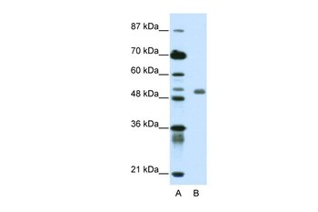DEAF1 Rabbit Polyclonal Antibody