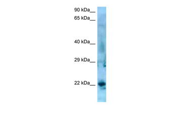 SSX5 Rabbit Polyclonal Antibody