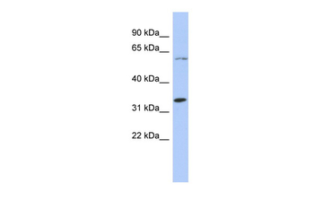 ZNF8 Rabbit Polyclonal Antibody
