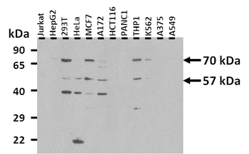 GRHL3 Rabbit Polyclonal Antibody