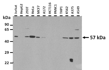 GRHL3 Rabbit Polyclonal Antibody