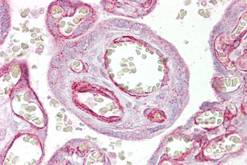 GRHL3 Rabbit Polyclonal Antibody