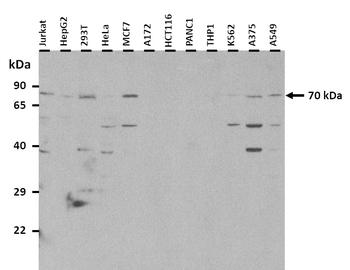 GRHL3 Rabbit Polyclonal Antibody