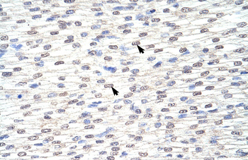 GRHL3 Rabbit Polyclonal Antibody
