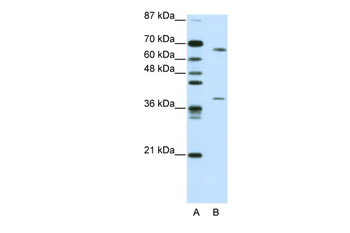 GRHL3 Rabbit Polyclonal Antibody