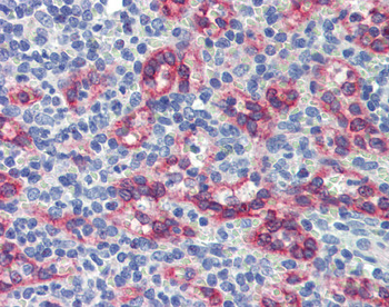 ZNF71 Rabbit Polyclonal Antibody