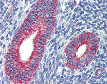 ZNF71 Rabbit Polyclonal Antibody