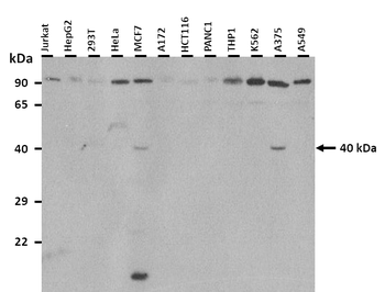 PRDM12 Rabbit Polyclonal Antibody