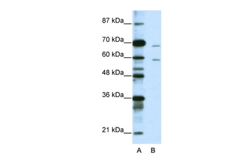 FOXA2 Rabbit Polyclonal Antibody