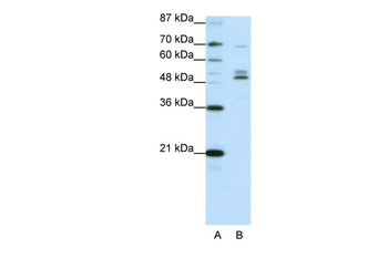 FOXA2 Rabbit Polyclonal Antibody