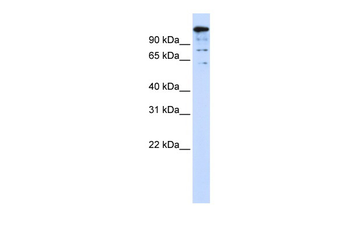 BACH2 Rabbit Polyclonal Antibody