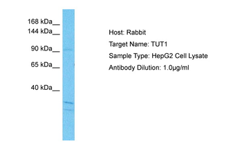 TUT1 Rabbit Polyclonal Antibody