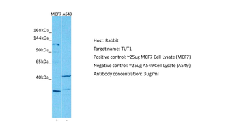 TUT1 Rabbit Polyclonal Antibody