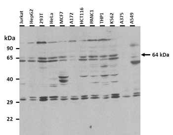 EBF1 Rabbit Polyclonal Antibody