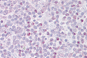 EBF1 Rabbit Polyclonal Antibody
