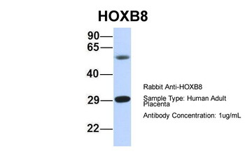 HOXB8 Rabbit Polyclonal Antibody