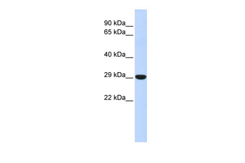 HOXB8 Rabbit Polyclonal Antibody