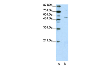 ZNF329 Rabbit Polyclonal Antibody