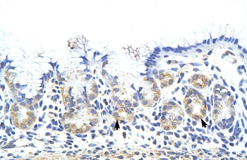 ZNF322A Rabbit Polyclonal Antibody