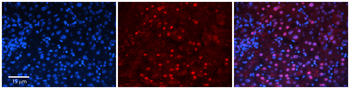 ZNF419 Rabbit Polyclonal Antibody
