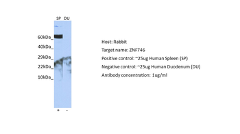 ZNF746 Rabbit Polyclonal Antibody