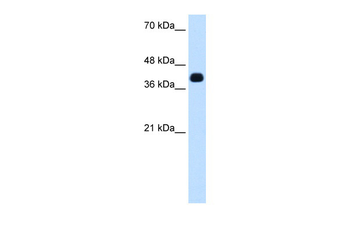 ZSCAN16 Rabbit Polyclonal Antibody