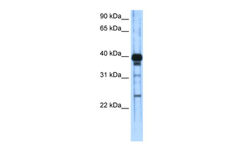 ZSCAN16 Rabbit Polyclonal Antibody