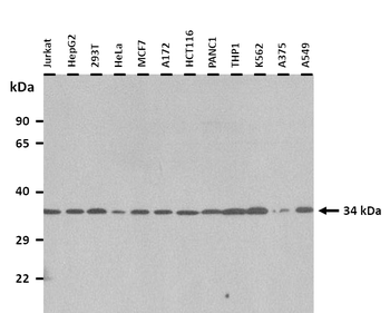 OTP Rabbit Polyclonal Antibody