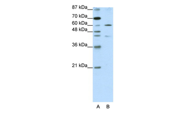 ZNF496 Rabbit Polyclonal Antibody