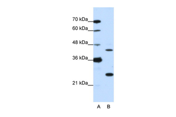 RIOX2 Rabbit Polyclonal Antibody
