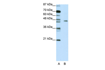 RIOX2 Rabbit Polyclonal Antibody