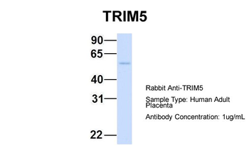 TRIM5 Rabbit Polyclonal Antibody