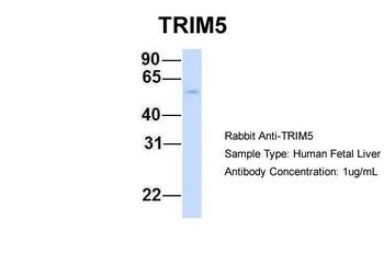 TRIM5 Rabbit Polyclonal Antibody