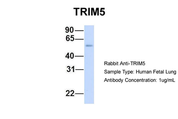 TRIM5 Rabbit Polyclonal Antibody