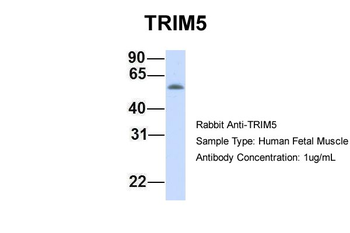 TRIM5 Rabbit Polyclonal Antibody