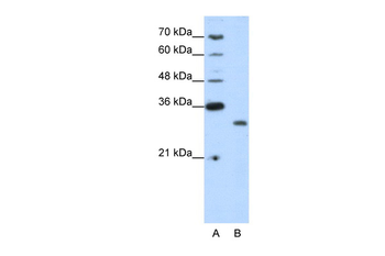 CPXCR1 Rabbit Polyclonal Antibody