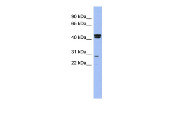 HSFY1 Rabbit Polyclonal Antibody