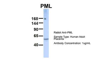 PML Rabbit Polyclonal Antibody