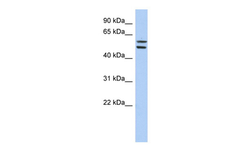 ZNF513 Rabbit Polyclonal Antibody