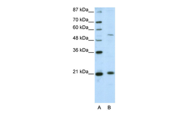 ZNF31 Rabbit Polyclonal Antibody