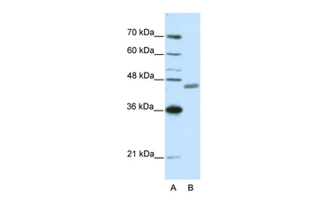 ZNF396 Rabbit Polyclonal Antibody