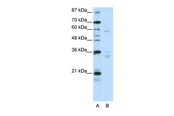 ZNF440 Rabbit Polyclonal Antibody