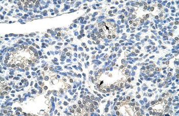 ZNF786 Rabbit Polyclonal Antibody