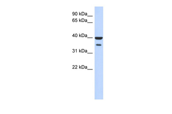 ZNF785 Rabbit Polyclonal Antibody