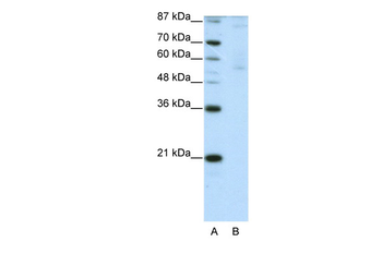 ZNF92 Rabbit Polyclonal Antibody