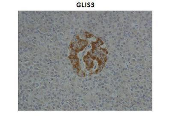 GLIS3 Rabbit Polyclonal Antibody