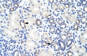 ZBTB9 Rabbit Polyclonal Antibody