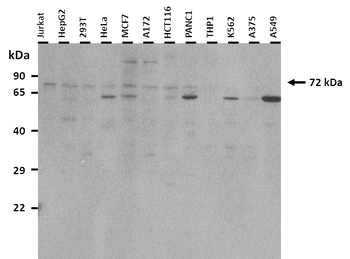 HIF3A Rabbit Polyclonal Antibody